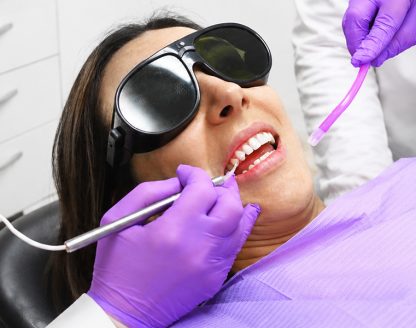 All Information about Tooth Bonding You Wanted to Have 