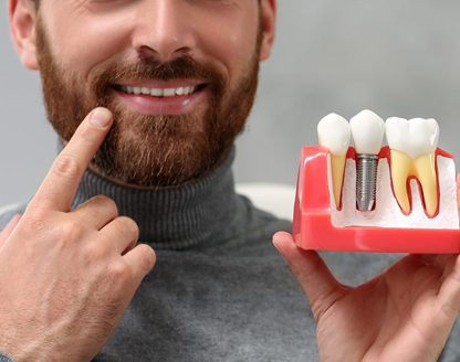 Should Dental Implants Cost Concern You When Replacing Missing Teeth? 