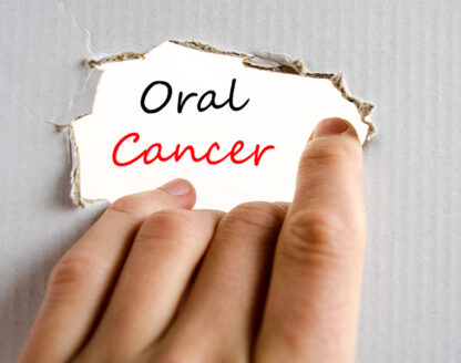 What Are the Signs of Oral Cancer Screening? 