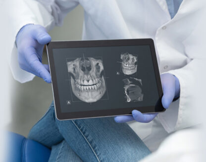 3D-X-Rays and Early Detection: A Game-Changer in Preventive Dentistry 
