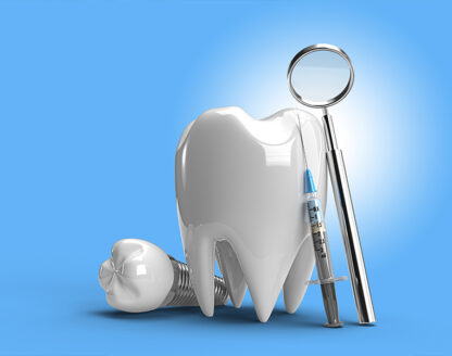 5 Facts About Dental Implants 
