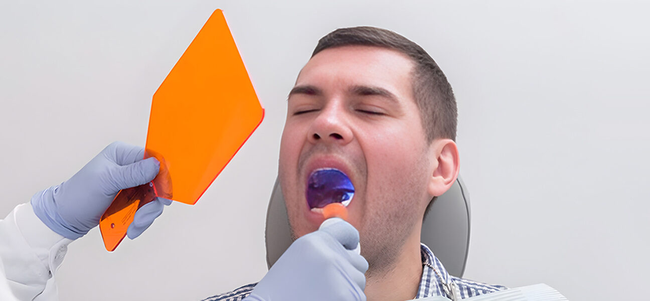Tooth Extraction and Recovery Tips from San Diego Dentists