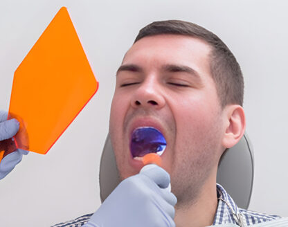 Tooth Extraction and Recovery Tips from San Diego Dentists 