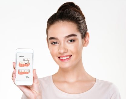 The Importance of Replacing Missing Teeth With Dental Bridges 