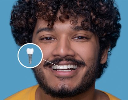 The Technology Behind Modern Dental Implants 