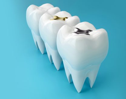 Scripps Poway Dental Care 