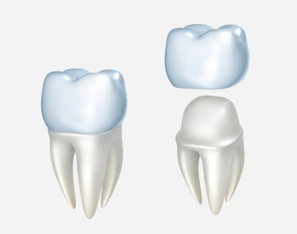 How Dental Crowns Restore Strength and Appearance 