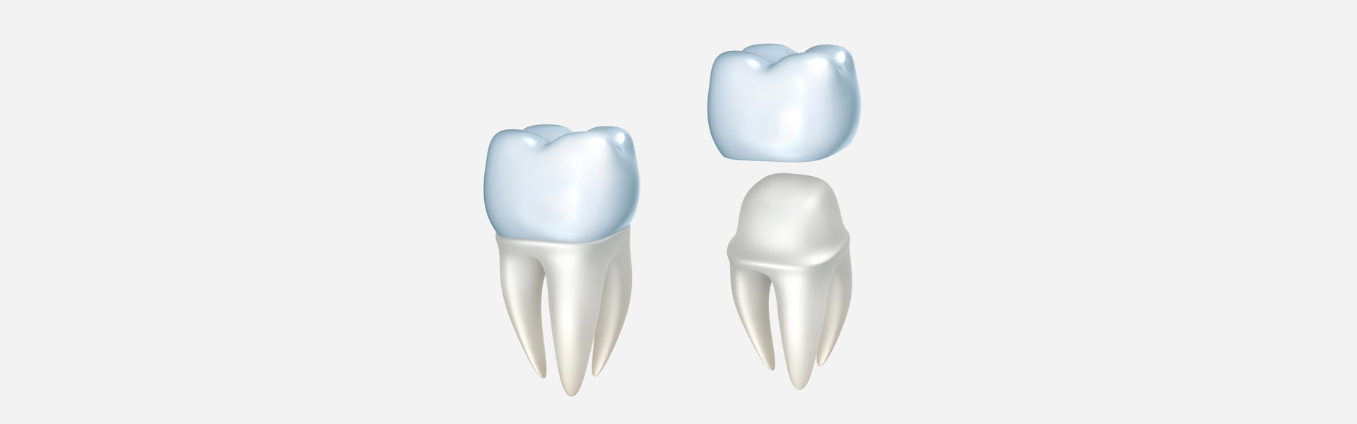 How Dental Crowns Restore Strength and Appearance